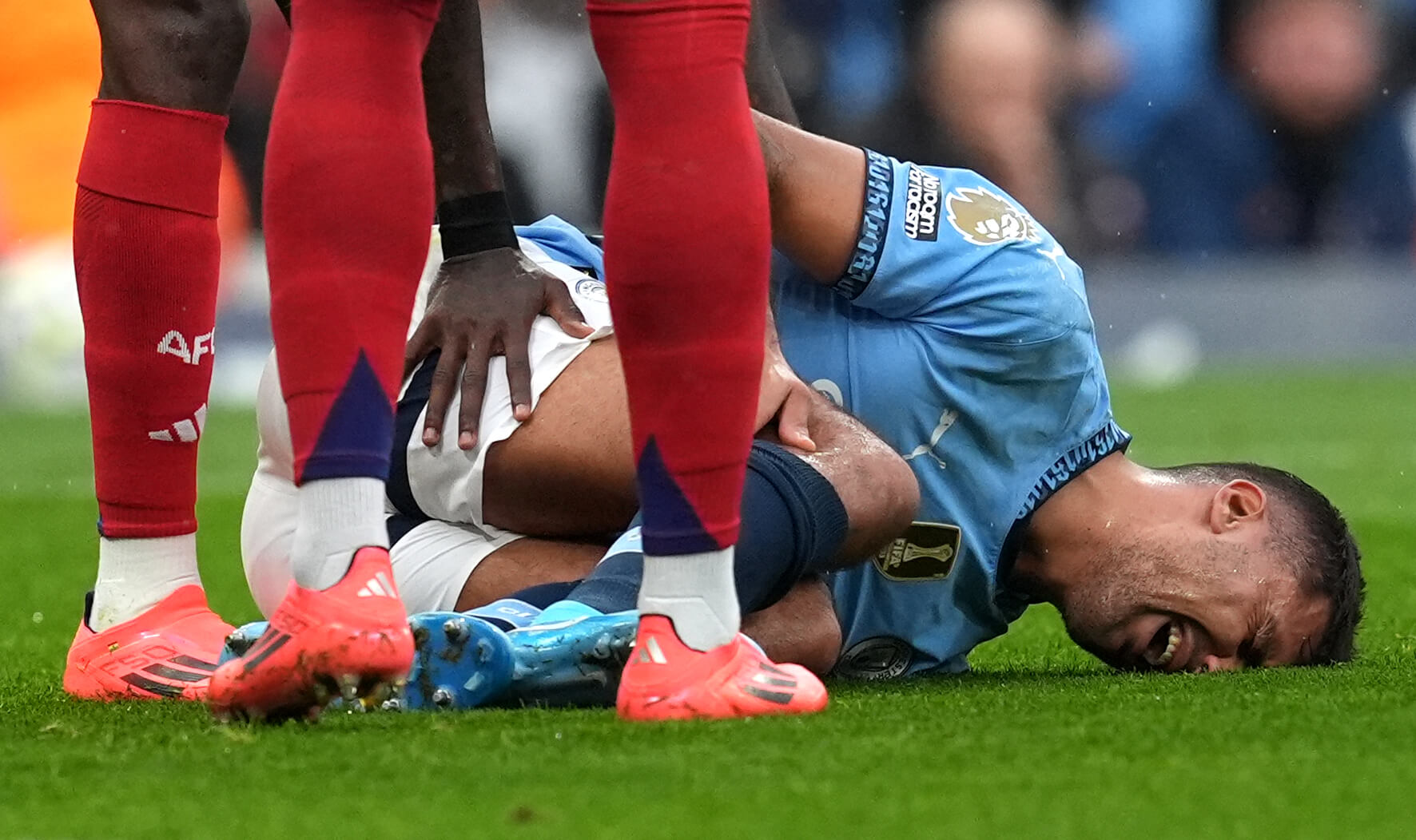 Rodri's ACL injuries and men cartilage are very serious types of injuries