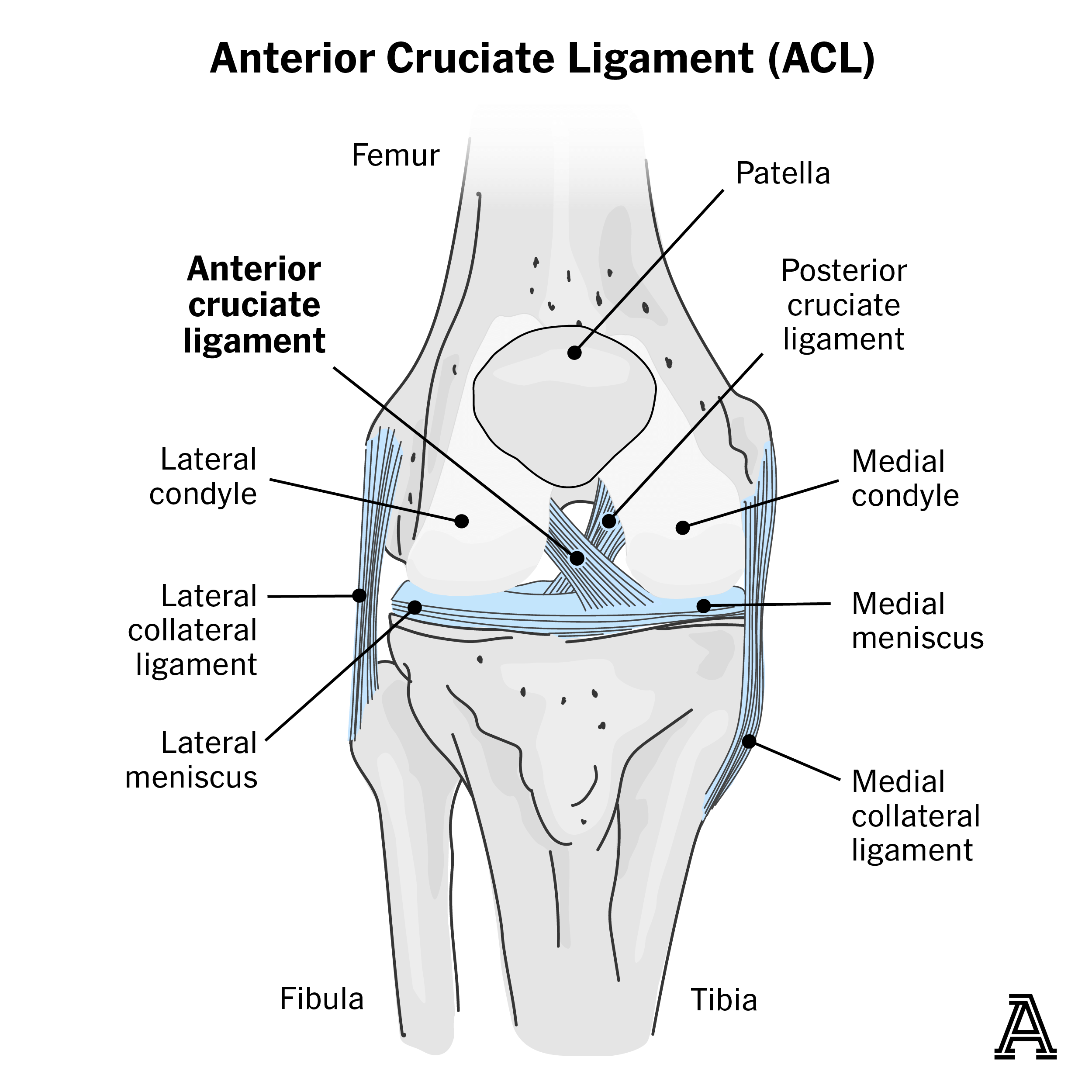 Ligament shaped in ACL
